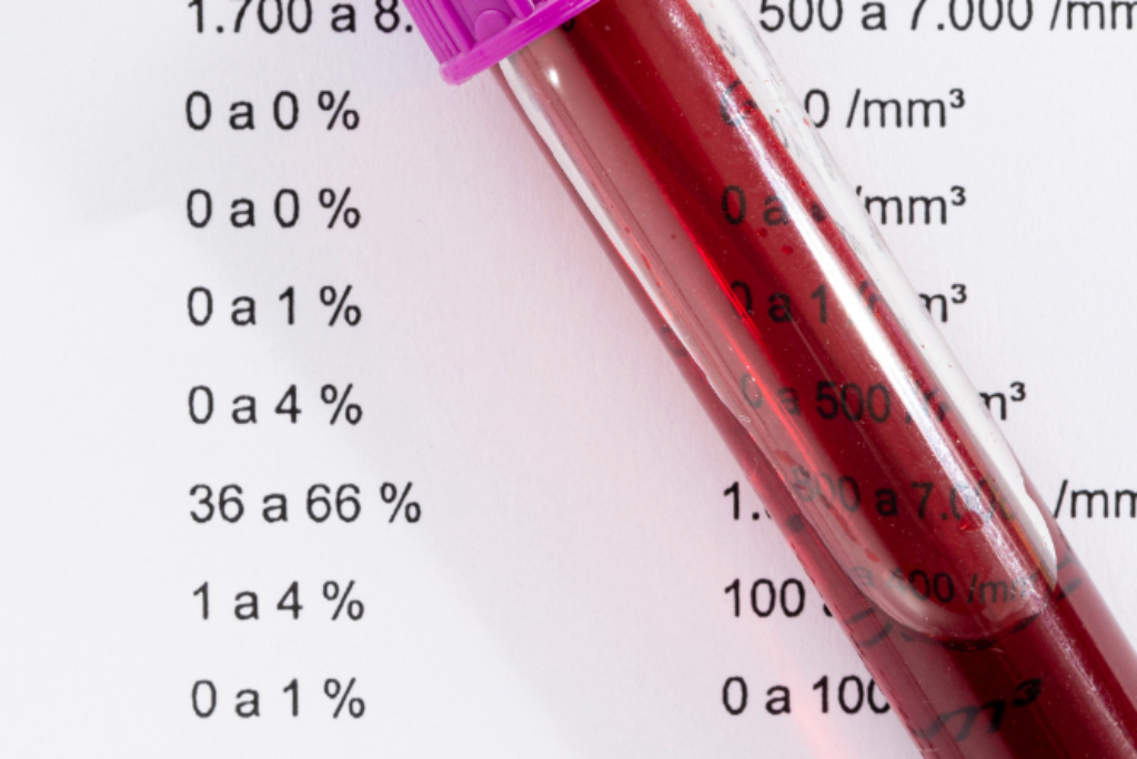 O que o Hemograma pode revelar sobre sua saúde