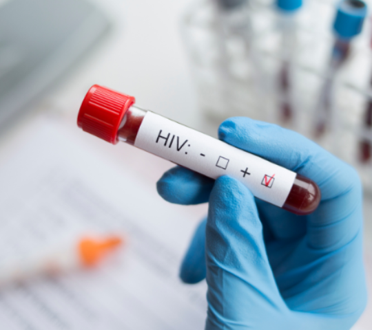 HIV